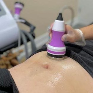 Ultrasonic-Cavitation